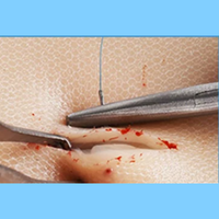 Modèle d'entraînement aux plaies saignantes, coussin de suture en silicone avec circulation sanguine simulée pour la formation des étudiants en médecine