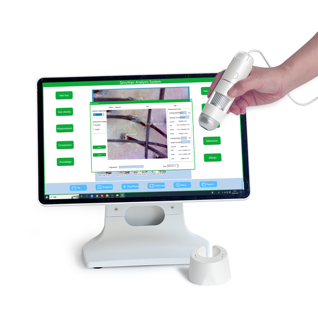 Windows System with Report USB Connect Hair Follicle Scanning Hair Scalp Analyser Machine