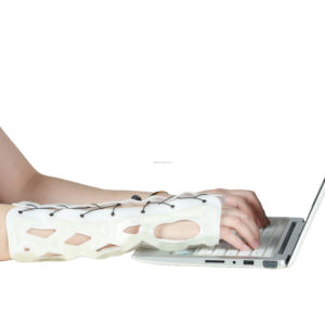 <span class=keywords><strong>Attelle</strong></span> médicale pour main et <span class=keywords><strong>poignet</strong></span>, immobilisateur de main et de <span class=keywords><strong>poignet</strong></span> à durcissement à la lumière - Product Image 2