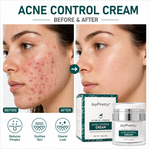 Crema para el Control del Acné OEM <span class=keywords><strong>de</strong></span> Marca Privada con Árbol <span class=keywords><strong>de</strong></span> Té, Vitamina B3 y Ácido Salicílico, Crema para el Tratamiento <span class=keywords><strong>de</strong></span> Puntos Negros y Espinillas para Piel Grasa - Product Image 1