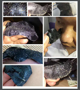 Private Label pulizia profonda rimozione di <span class=keywords><strong>punti</strong></span> <span class=keywords><strong>neri</strong></span> Patch strisce per il trattamento dei pori del naso per assorbire i brufoli Acne <span class=keywords><strong>cerotto</strong></span> idrocolloide per il naso - Product Image 4