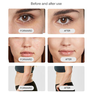 <span class=keywords><strong>Appareil</strong></span> 5D MAX 2026 à succès, 5 cartouches 2/3/4,5 mm, lifting du visage non invasif, resserrement de la peau et réduction des rides, utilisation à domicile - Product Image 5