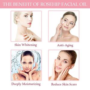 Aceite de Rosa Mosqueta Orgánico al por Mayor de Fábrica, Aceite de Rosa Mosqueta Prensado en Frío para el Rostro, Materia Prima Cosmética al por Mayor, Aceite Portador Orgánico - Product Image 3