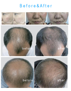 เครื่องเมโสเธอราพี MESO SKIN ดูอัล เทคโนโลยี ไมโครชิป อิเล็กโทรโพเรชั่น สกิน บูสเตอร์ - Product Image 6