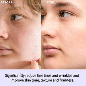 Retinol alternatif yüz Serum için özel Bakuchiol peptidleri ay meyve nemlendirici nemlendirici Anti-Aging sıvı beyazlatma için - Product Image 4