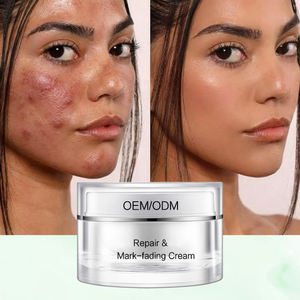 Crème anti-acné à base de plantes <span class=keywords><strong>en</strong></span> vrac KG - <span class=keywords><strong>Produit</strong></span> semi-fini - Matière première <span class=keywords><strong>en</strong></span> <span class=keywords><strong>gros</strong></span> pour l'atténuation des marques et des cicatrices d'acné - Product Image 2