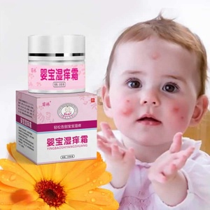 Crème anti-démangeaisons pour les infections fongiques, démangeaisons, teigne, eczéma cutané, crème apaisante pour bébé, 20g, formule douce à base de plantes - Product Image 1