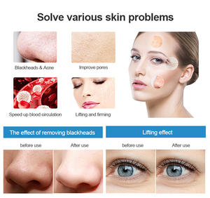 最畅销的产品便携式痤疮去除皮肤洗涤器面部洗涤器黑头卸妆美容个人护理工具 - Product Image 3