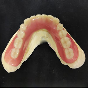 Fournitures dentaires : Prothèses dentaires complètes <span class=keywords><strong>en</strong></span> acrylique adsorbant pour toute la mâchoire, avec tissus gingivaux - Product Image 4