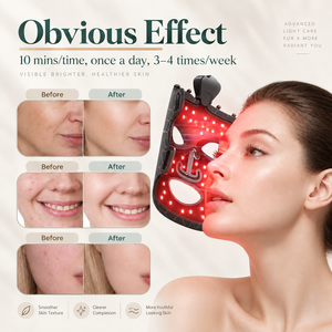 Máscara Facial de Silicona en Oferta, 7 Colores, Flexible, Tratamiento para el Acné, Exfoliante Facial, Rejuvenecimiento, Eliminador de Arrugas, Uso Inalámbrico - Product Image 6