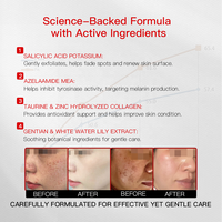 Crème professionnelle éclaircissante pour les taches brunes et les taches de rousseur, à l'acide azélaïque et à l'acide salicylique, pour le mélasma, les taches de vieillesse et l'hyperpigmentation, exfoliante douce