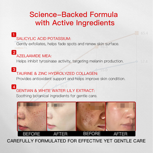 ครีมกำจัดจุดด่างดำ <span class=keywords><strong>ฝ้า</strong></span> <span class=keywords><strong>กระ</strong></span> รอยดำจากวัย ด้วยกรดอะซีเลอิกและกรดซาลิไซลิก ช่วยผลัดเซลล์ผิวอย่างอ่อนโยน - Product Image 3