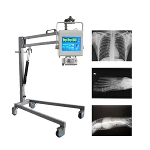 Máquina de raio x portátil hospital 5kw, telemóvel humano & veterinário portátil