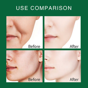 <span class=keywords><strong>Masque</strong></span> Anti-Acné Herbal Marque Blanche à la Poudre de <span class=keywords><strong>Nila</strong></span> Hydratant <span class=keywords><strong>Masque</strong></span> <span class=keywords><strong>Visage</strong></span> Gelée en Poudre - Product Image 4