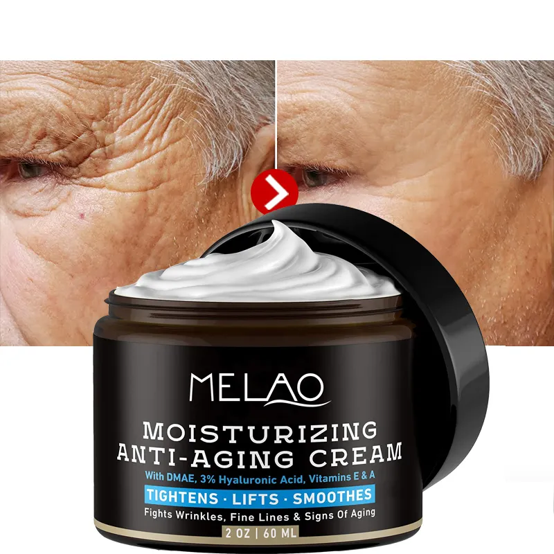 Özel etiket kore karanlık nokta temizleme kremi Anti Aging beyazlatma yüz kremi karanlık nokta çıkarma için