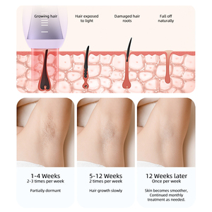 Dispositivo de Depilación IPL Permanente con Enfriamiento de Zafiro y Tecnología de Destello Rápido, Depiladora Portátil Indolora para Mujeres <span class=keywords><strong>en</strong></span> <span class=keywords><strong>Casa</strong></span> - Product Image 6