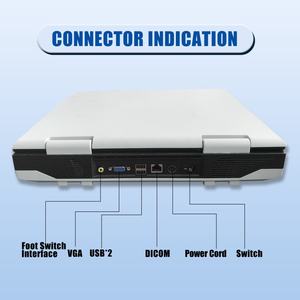 Bw-mode pemindai <span class=keywords><strong>Ultrasound</strong></span> medis, perangkat diagnostik Laptop skala hitam untuk pemantauan manusia - Product Image 5