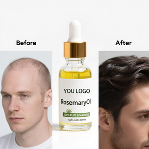 100% naturel soin du cuir chevelu bio romarin huile de ricin élixir de croissance sérum de densité - Product Image 2