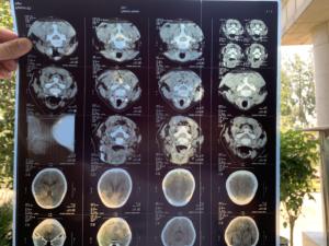 Hot Sale Hospital Clinic 8 "* 10" Zoll benutzer definierte Größe Blue Inkjet Medical Film für Tinten strahl drucker Röntgen-CT, CR, <span class=keywords><strong>DR</strong></span>, MTR, PET-CT usw. - Product Image 6