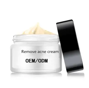 Creme chinês para acne, creme de remoção de acne e cicatriz para meninos e meninas