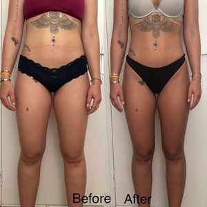 Le plus récent corps de Drainage lymphatique portatif sculptant les rouleaux intérieurs de boule de vide professionnel amincissant - Product Image 6