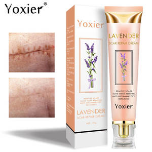 Creme Facial Yoxier Loção Reparadora de Cicatrizes de Acne Estrias Corretor de Pigmentação Antialérgico Calmante Clareador para Cuidados com a Pele - Product Image 2