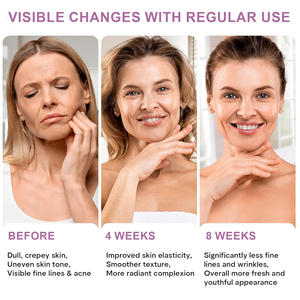 Crème de nuit anti-rides Bakuchiol pour les ridules, minimisant les pores, hydratante, collagène, rétinol, crème pour le visage - Product Image 6