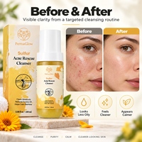 Nettoyant Visage Purifiant et Apaisant pour Peaux à Tendance Acnéique au Soufre Fermenté – Contrôle du Sébum, Purification des Pores, Élimination des Éruptions et Atténuation des Rougeurs