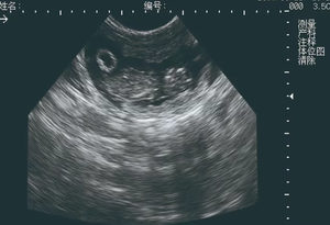 Mesin USG Genggam untuk Diagnosa Kehamilan Hewan, Mesin Ultrasound Veteriner untuk Babi dengan Probe Sektor Mekanis - Product Image 4