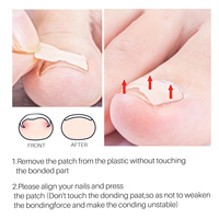Patchs de réparation des ongles multi-usages Traitement des ongles des orteils Autocollants de correction des ongles antifongique Patch de réparation des ongles de marque privée