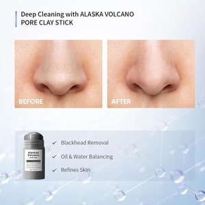 Mascarilla Facial en Barra de Arcilla Volcánica de <span class=keywords><strong>Alaska</strong></span>, Limpieza Profunda de Poros, Eliminador de Puntos Negros, Control de Grasa, Cuidado Facial - Product Image 4