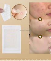Patch hydrocolloïde de marque privée pour bouton d'acné Produit de résolution de problèmes pour l'élimination des patchs nasaux et corporels Patch pour bouton d'acné
