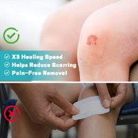 Stérile Étanche Très Absorbant Auto-Adhésif Lit Plaie Bandages Patch Hydrocolloïde Rouleau pour Brûler Blister Acné Pimple Care