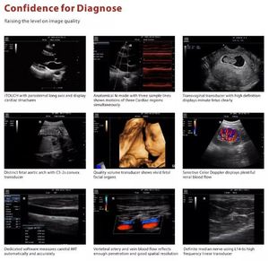 Ecógrafo Doppler Color 4D <span class=keywords><strong>Mindray</strong></span> <span class=keywords><strong>M7</strong></span>/M9, Precio del Escáner de Ultrasonido <span class=keywords><strong>Mindray</strong></span> - Product Image 4