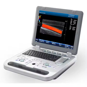 Échographie humaine rentable de machine portative d'échographie d'écho de <span class=keywords><strong>3D</strong></span> 4D - Product Image 4