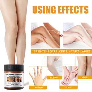 Niacinamida de fábrica para mujer, crema blanqueadora para las rodillas oscuras, nudillos, codos, axila, partes privadas, para piel oscura - Product Image 4