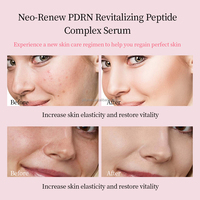 Exfoliant Liquide Hydratant et Raffermissant au Peptide Rose PDRN, Éclaircissant Anti-Taches Brunes à la Niacinamide pour une Peau Éclatante – Marque Privée