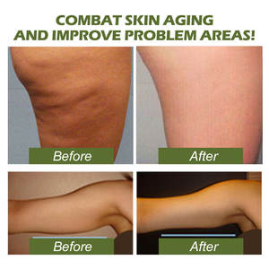 Nueva Crema y Loción Corporal Adelgazante Herbal Orgánica con Retinol - 50ml, Humectante Portátil para Aclarar la Piel y Reducir las Líneas Finas - Product Image 5