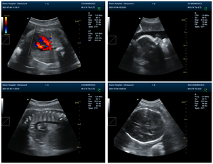 Portátil portátil Color Ultrasonido Escáner Máquina 3D Notebook tipo ultrasonido - Product Image 2