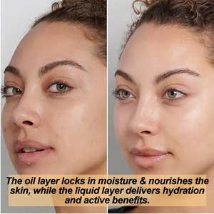 Suero y Aceite Facial con Arbutina para Tono de Piel Desigual, Pecas, Hiperpigmentación - Iluminador Bifásico Suave que se Activa con un Agitado - Product Image 3