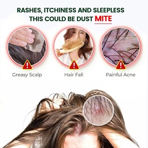 Crème anti-acariens naturelle à base de plantes de haute qualité-Apaise les démangeaisons du cuir chevelu, élimine les acariens du cuir chevelu, doux pour un usage quotidien - Product Image 5