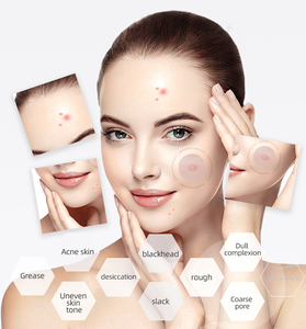 เครื่องวิเคราะห์ผิวหนัง AI 3 กล้อง พร้อมหน้าจอสัมผัส ใช้พลังงาน AI แบบพกพาสำหรับการวิเคราะห์สภาพผิว - Product Image 4