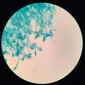 Portaobjetos de Microscopio con Algas y <span class=keywords><strong>Hongos</strong></span> para la Enseñanza de Biología en Secundaria, Especímenes Preparados con Estructuras Fúngicas Típicas, ISO - Product Image 4
