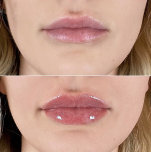 ลิปกลอสเพิ่มวอลลุ่มริมฝีปากแบบวีแกน ติดทนนาน ให้ริมฝีปากอวบอิ่ม พร้อมรับผลิตแบรนด์ส่วนตัว - Product Image 5