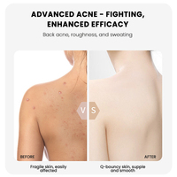Spray corporel biologique MULAN - Vente en gros, exfoliant, nourrissant, blanchissant, hydratant pour l'acné du dos, peau rugueuse et grasse
