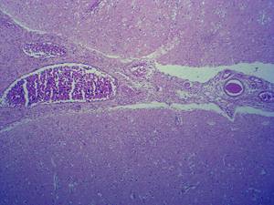 निर्माता मानव पैथोलॉजी अनुभाग स्लाइड 100 मानव स्थानीय सूजन माइक्रोस्कोप उपकरण के टुकड़ों का उत्पादन करते हैं - Product Image 2
