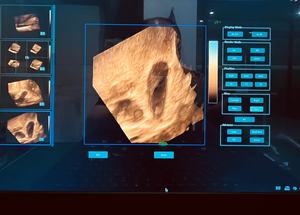 Ecógrafos Veterinarios 2D <span class=keywords><strong>3D</strong></span> Doppler a Color, <span class=keywords><strong>Precio</strong></span> <span class=keywords><strong>de</strong></span> Fábrica, Máquina <span class=keywords><strong>de</strong></span> Ultrasonido Veterinario Portátil - Product Image 2