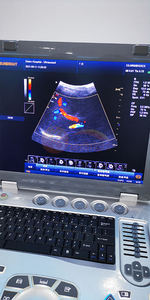 Sistema de Diagnóstico por Ultrasonido Portátil Médico <span class=keywords><strong>Doppler</strong></span> a Color Sunbright SUN-906B para <span class=keywords><strong>Ecocardiograma</strong></span> - Product Image 5