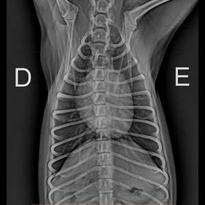 Detector de panel plano inalámbrico médico 14*17 ''Detector de radiografía digital de rayos X portátil - Product Image 5