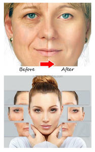 Private Label la migliore crema antietà per la rimozione della pelle rassodante per l'invecchiamento delle formiche - Product Image 5